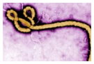 Ebola